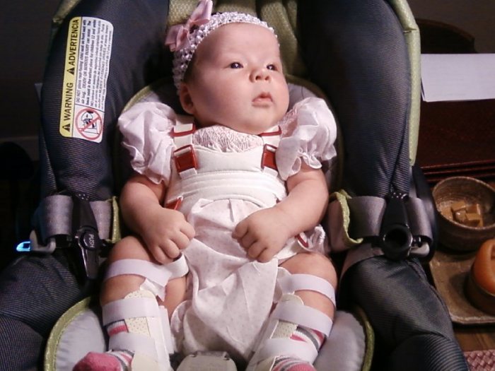 Hips and Healing: Lily’s Story